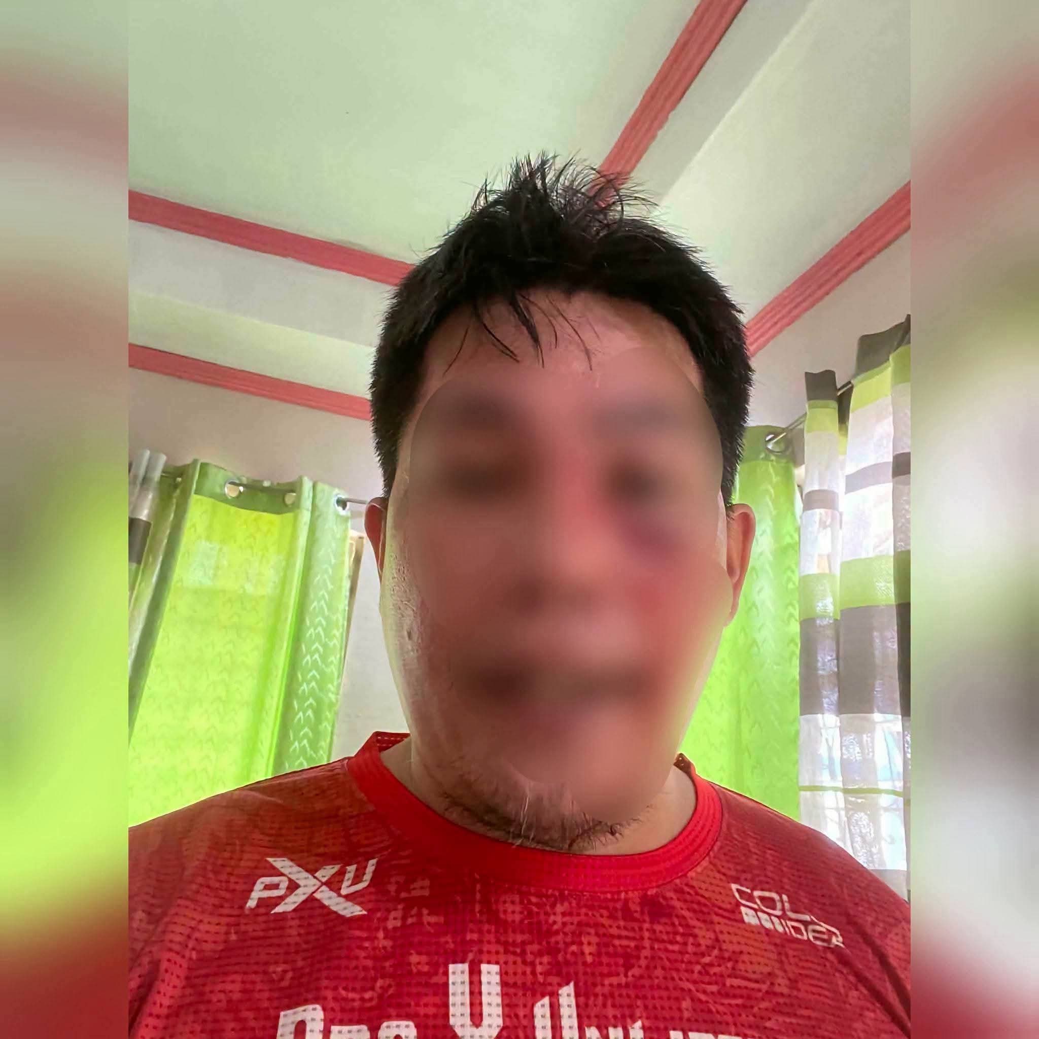 Pulis sugatan sa mukha matapos suntukin ng Grade 11 student sa Bacolod City